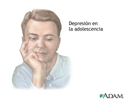 Depresion en adolescentes